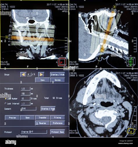 Ct Scans Of Human Head Stock Photo Alamy