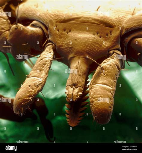 Sheep Tick Mouthparts Coloured Scanning Electron Micrograph Sem Of