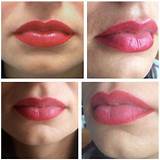 Photos of Permanent Makeup Lips