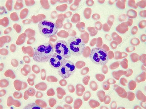 Banded Neutrophils Lm Stock Image C0435186 Science Photo Library
