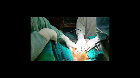 Perineal Urethrostomy Surgery Total Penectomy With Perineal