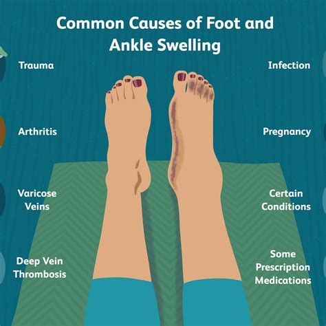 Foot Ankle Swelling Causes