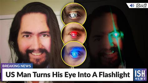 Us Man Turns His Eye Into A Flashlight Ish News Youtube