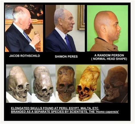 Jacob Rothschild Himon Pere A Random Person Normal Head Shape