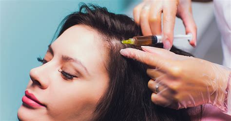 The selection of treatment is based on the extent of hair loss, grade of baldness as well as condition of the hair and the scalp. Hair Loss Treatment with PRP Injections | Virginia, and ...