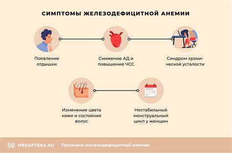 Железодефицитная анемия симптомы, лечение, причины Картинка - Железодефицитная анемия симптомы, лечение, причины