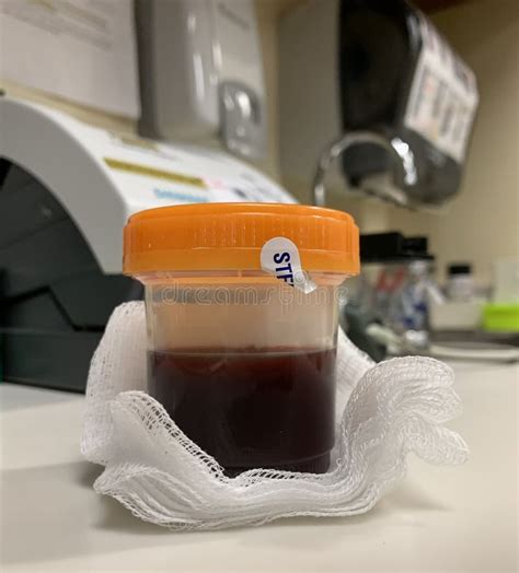 Blood In Urine Test Stock Photo Image Of Blood Antibiotics 216967578