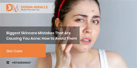 Skincare Mistakes That Are Causing Acne How To Avoid Them