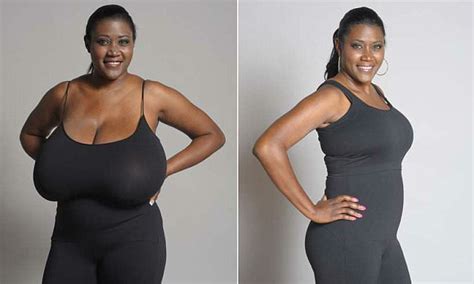 Kerisha Mark With Nnn Breasts Has Lbs Of Tissue Removed After Condition Daily Mail Online