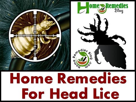 15 Best Home Remedies For Head Lice And Nits Home Remedies Blog