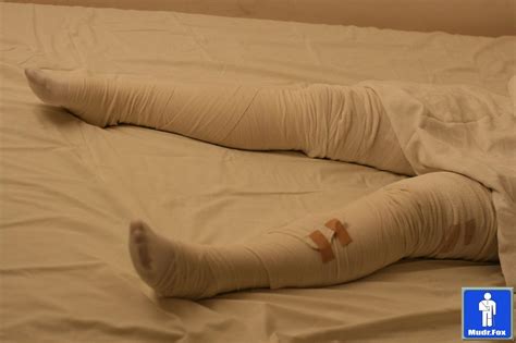 Bandaged Legs By Caster1210 On Deviantart