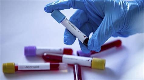Le certificat covid est un moyen de documenter une vaccination complète, une infection guérie ou un test négatif. Tunisie / Covid-19: Un test négatif au coronavirus ...