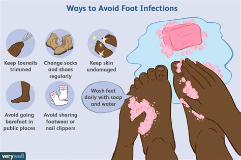 Common Fungal And Bacterial Infections Of The Foot