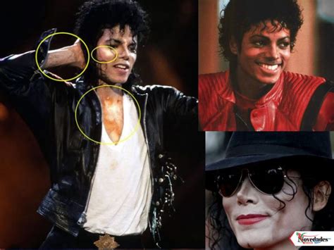 C Mo Le Hizo Michael Jackson Para Hacerse De Piel Blanca Novedades News