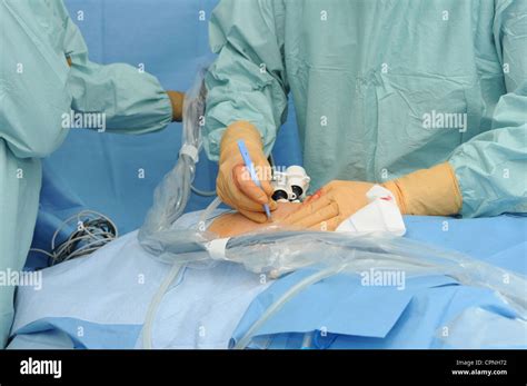 Prostate Surgery Hi Res Stock Photography And Images Alamy