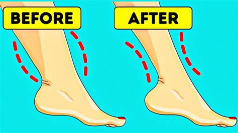 I Have Thick Ankles 🌈9 Ways To Get Rid Of Cankles
