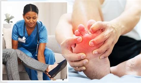Gout In Ankle Joint The Key Symptoms You Should Never Ignore Express