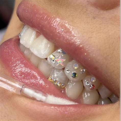 Opal Tooth Gems Star Tooth Gems Tooth Gem Design Ideas Tooth Gems