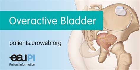 Overactive Bladder Syndrome Patient Information