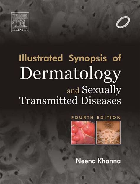 Illustrated Synopsis Of Dermatology And Sexually Transmitted Diseases E