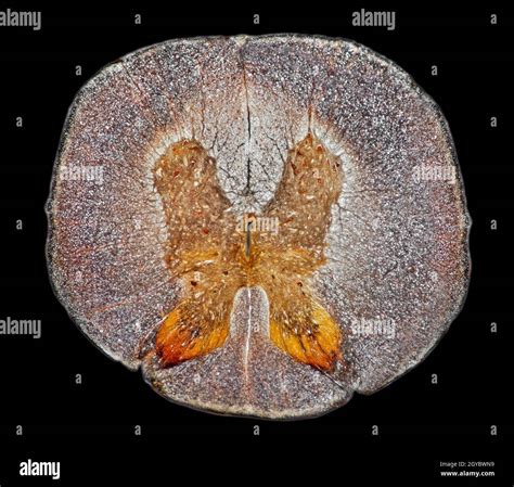 Mammal Spinal Cordts Stock Photo Alamy