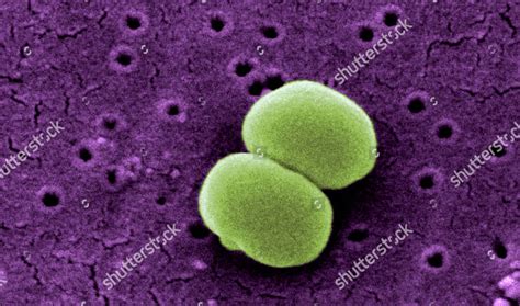 Staphylococcus Epidermidis Sem Editorial Stock Photo Stock Image