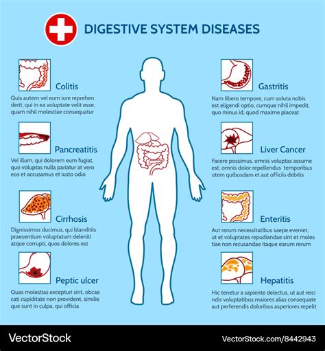 Human Digestive System Diseases Royalty Free Vector Image