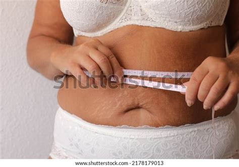 Cropped Photo Naked Overweight Woman Belly Shutterstock