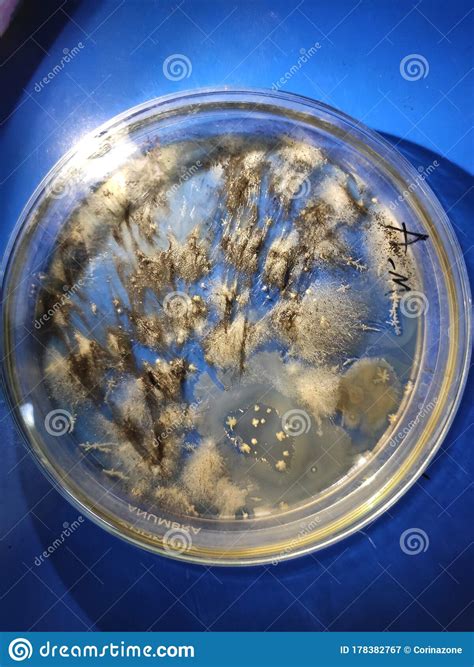 Aspergillus Niger Fungus Growing On Sabouraud Dextrose Agar Medium