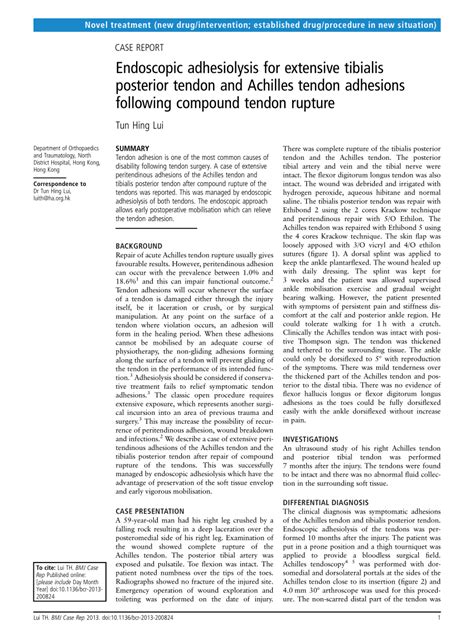 Endoscopic Adhesiolysis For Extensive Tibialis Posterior Tendon And