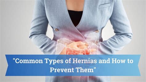 Common Types Of Hernias And How To Prevent Them