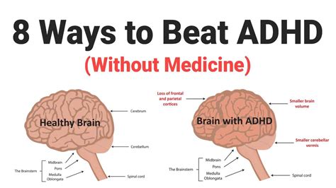 8 Ways To Beat Adhd Without Medicine