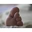 Hammer Toe Causes Symptoms And Diagnosis