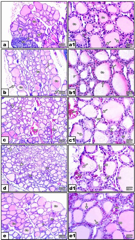 Photomicrographs Of Histological Sections Of The Thyroid Gland Stained