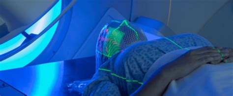 External Beam Radiation Therapy Ebrt An Overview
