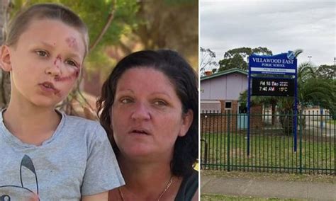 Horrified Mother Speaks Out After Her Autistic Son Was Tripped And Kicked By Cruel Bullies