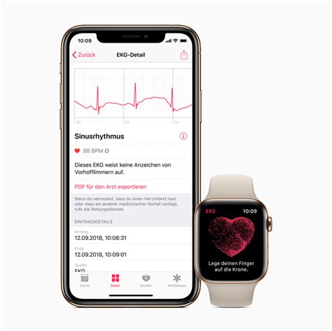 Local resources who if you're not eligible for apple health, you may qualify for help with your health insurance or for other. ECG app and irregular rhythm notification on Apple Watch ...