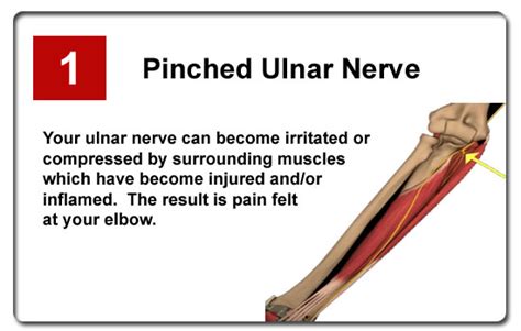 Top 5 Causes Of Elbow Pain Doing Pull Ups In The Gym Or At Home