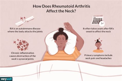 Rheumatoid Arthritis In The Neck Overview And More
