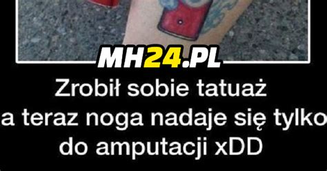 Noga Do Amputacji Xd Mh Pl Humor Mieszne Dowcipy I Kawa Y