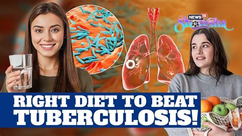 World Tuberculosis Day Foods To Eat And Avoid If You Are A Tb