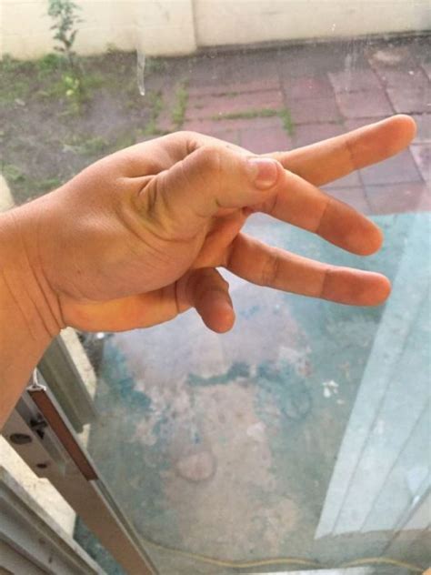 Here where you can go as creative as possible. How To Dislocate Your Thumb (14 pics)