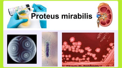 Proteus Mirabilis Youtube