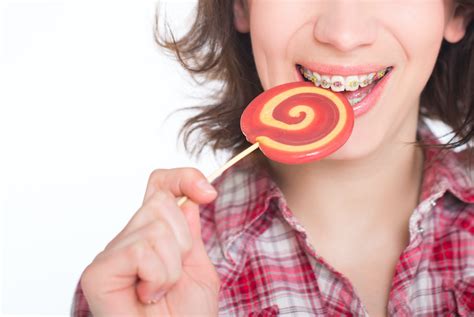 In pandemic, group with braces should refrain firm, brushed foods, crunchy or sticky. Foods to Avoid Eating With Braces | Charleston Orthodontist