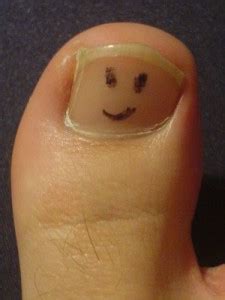 It may be numb or firm to feel and doesn't fade they may look like a patch or a lump or look like an ulcer. All-Time Thumb Wars Champ! | The Luxury Spot