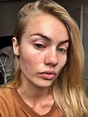 Elyse Knowles Without Makeup - No Makeup Pictures - Makeup-Free Celebs