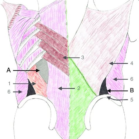 Anatomical Location Of Primary Lumbar Hernias Download Scientific Diagram