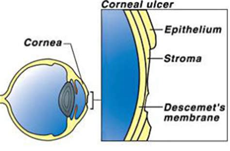 Some of them are too stubborn to heal within as short. Corneal Ulcers - City Beach Vet