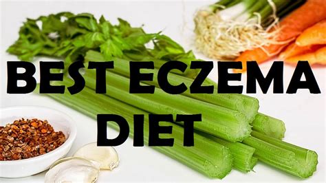 How To Cure Your Eczema Naturally Best Eczema Diet Youtube