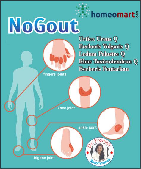 Gout Relief With These Top Homeopathic Remedies Homeopathy Medicine